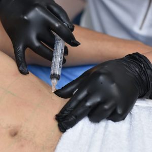 mesoterapia
